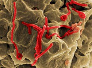 Prevención De la infección por el Virus del Ébola